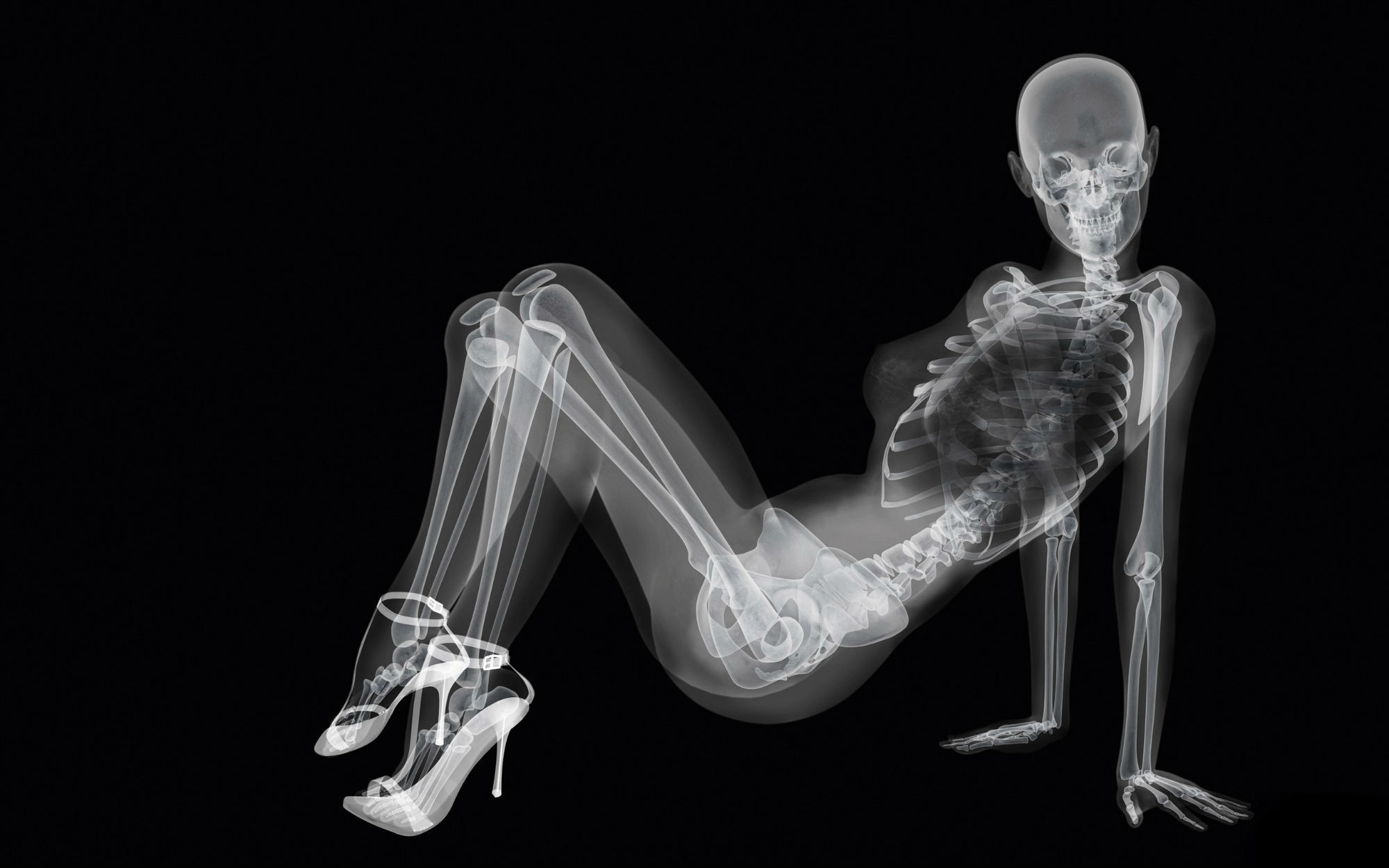 X-ray рентген скелет